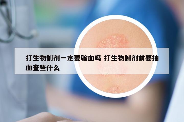 打生物制剂一定要验血吗 打生物制剂前要抽血查些什么