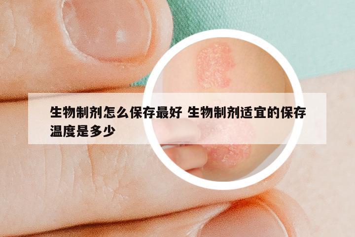 生物制剂怎么保存最好 生物制剂适宜的保存温度是多少