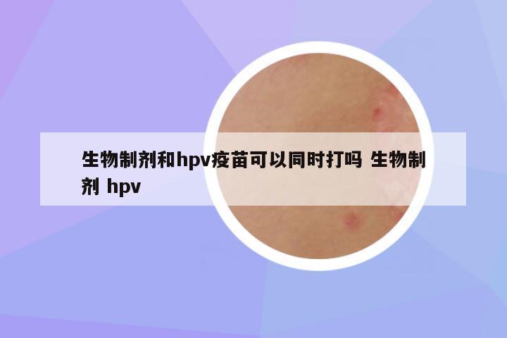 生物制剂和hpv疫苗可以同时打吗 生物制剂 hpv