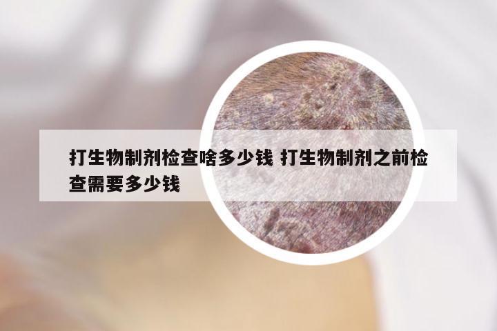 打生物制剂检查啥多少钱 打生物制剂之前检查需要多少钱