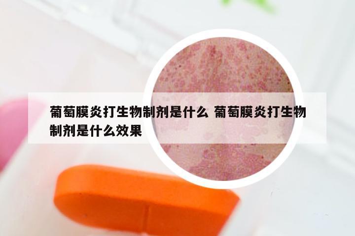 葡萄膜炎打生物制剂是什么 葡萄膜炎打生物制剂是什么效果