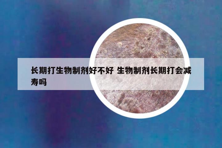 长期打生物制剂好不好 生物制剂长期打会减寿吗