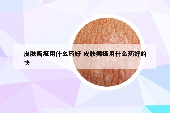 皮肤癣痒用什么药好 皮肤癣痒用什么药好的快