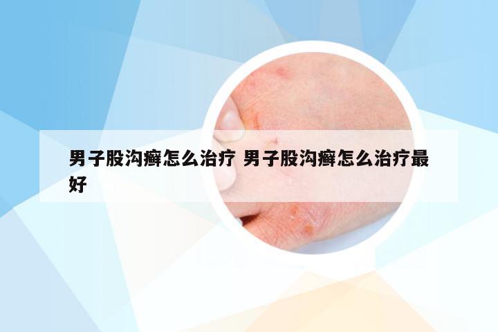 男子股沟癣怎么治疗 男子股沟癣怎么治疗最好