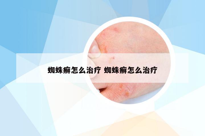 蜘蛛癣怎么治疗 蜘蛛癣怎么治疗