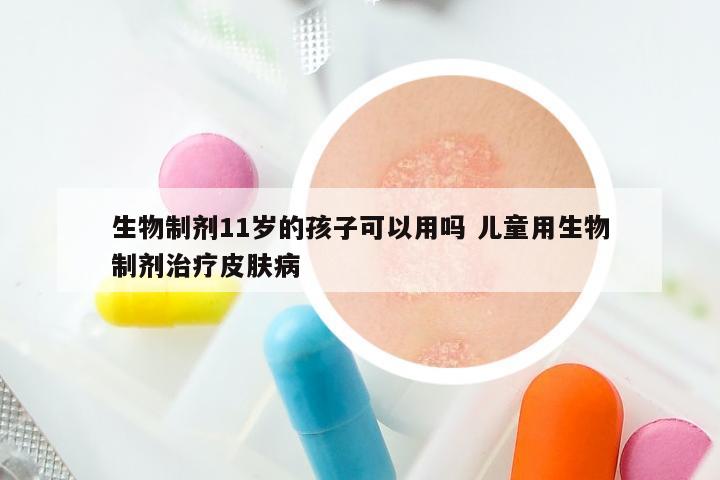 生物制剂11岁的孩子可以用吗 儿童用生物制剂治疗皮肤病