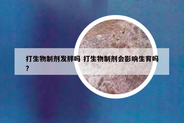 打生物制剂发胖吗 打生物制剂会影响生育吗?