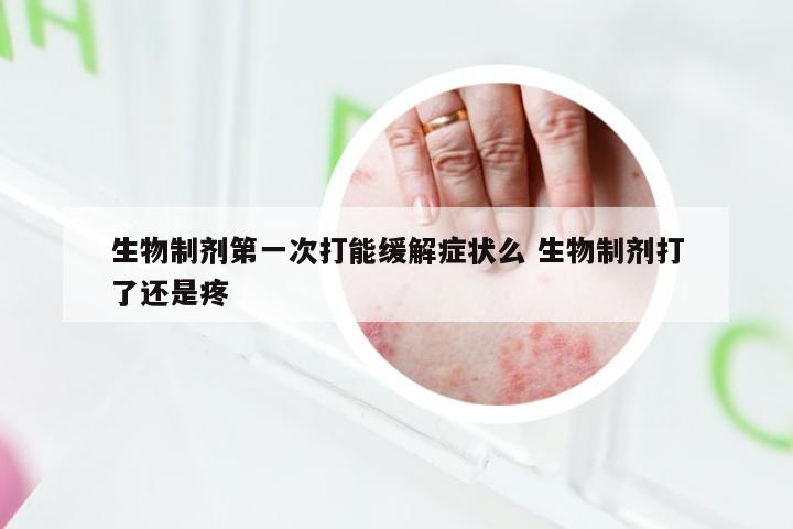 生物制剂第一次打能缓解症状么 生物制剂打了还是疼