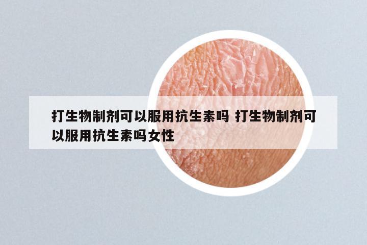 打生物制剂可以服用抗生素吗 打生物制剂可以服用抗生素吗女性