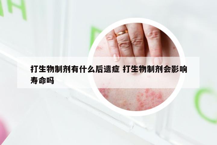 打生物制剂有什么后遗症 打生物制剂会影响寿命吗