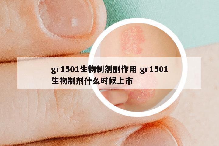 gr1501生物制剂副作用 gr1501生物制剂什么时候上市