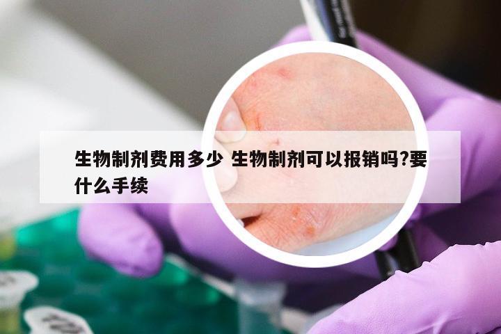 生物制剂费用多少 生物制剂可以报销吗?要什么手续