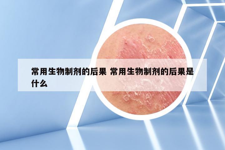 常用生物制剂的后果 常用生物制剂的后果是什么