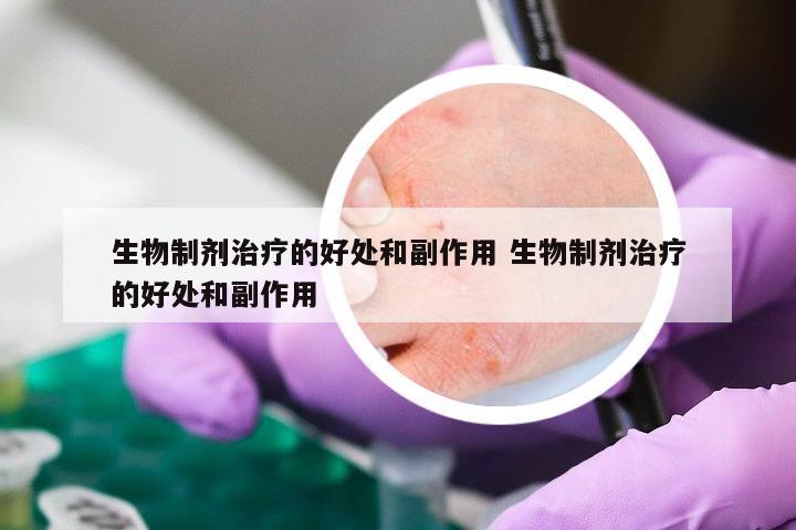 生物制剂治疗的好处和副作用 生物制剂治疗的好处和副作用