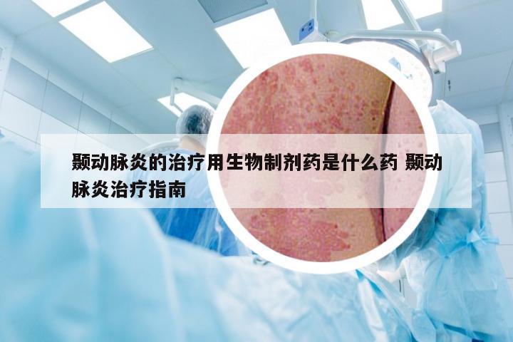 颞动脉炎的治疗用生物制剂药是什么药 颞动脉炎治疗指南