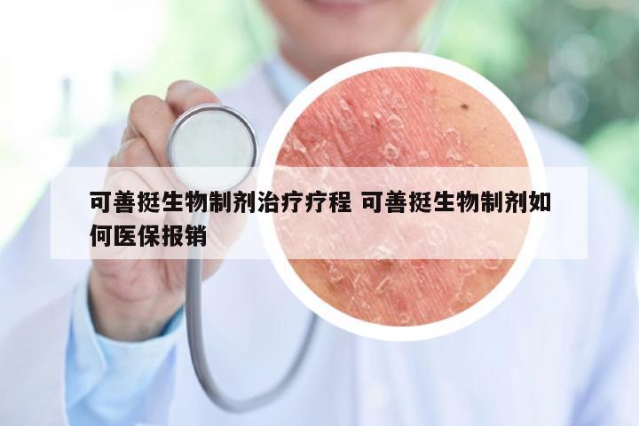 可善挺生物制剂治疗疗程 可善挺生物制剂如何医保报销