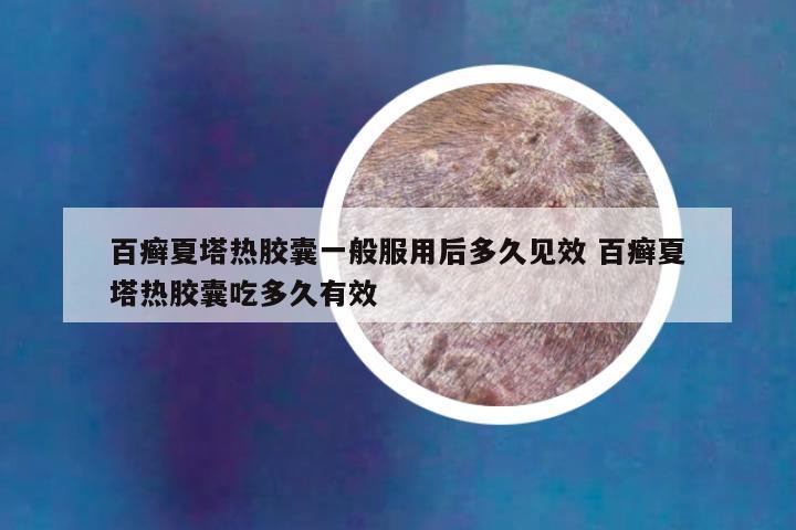 百癣夏塔热胶囊一般服用后多久见效 百癣夏塔热胶囊吃多久有效