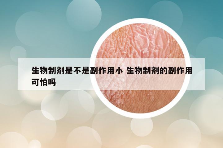 生物制剂是不是副作用小 生物制剂的副作用可怕吗