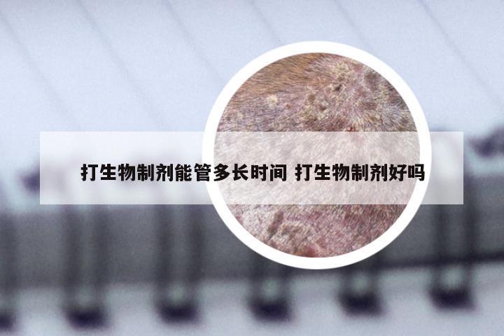 打生物制剂能管多长时间 打生物制剂好吗