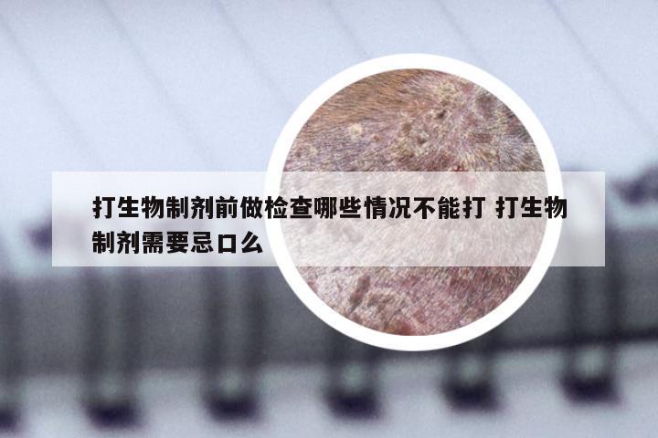 打生物制剂前做检查哪些情况不能打 打生物制剂需要忌口么