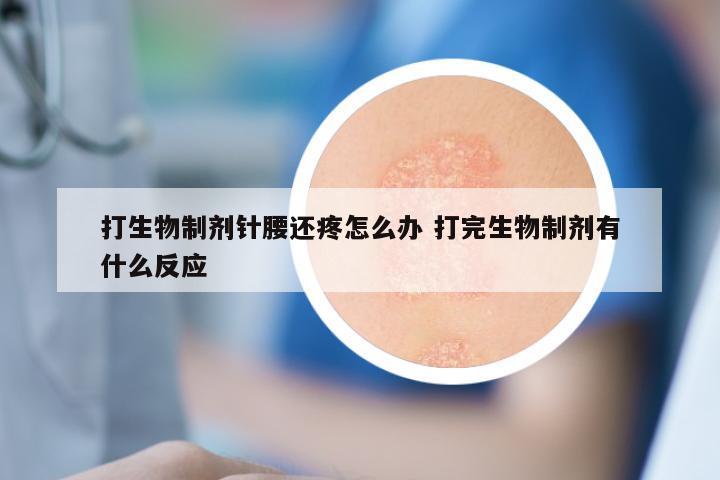 打生物制剂针腰还疼怎么办 打完生物制剂有什么反应