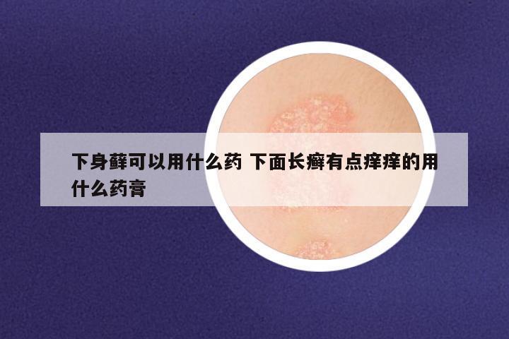 下身藓可以用什么药 下面长癣有点痒痒的用什么药膏