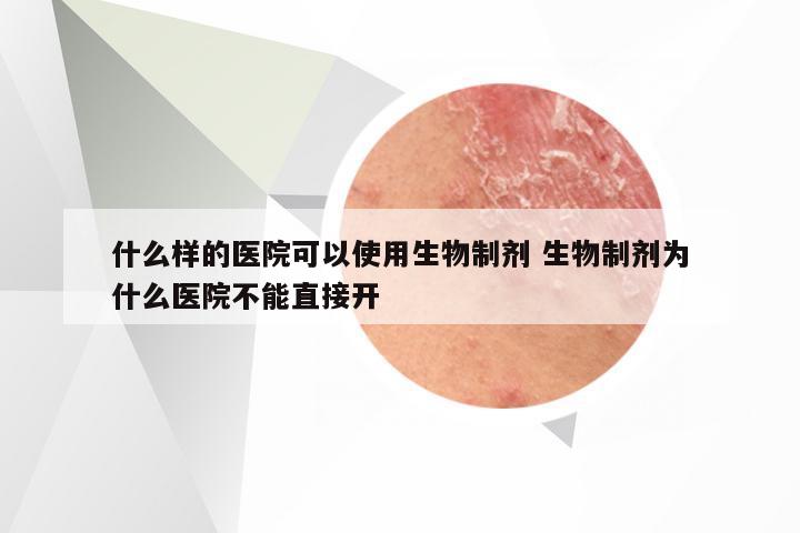 什么样的医院可以使用生物制剂 生物制剂为什么医院不能直接开