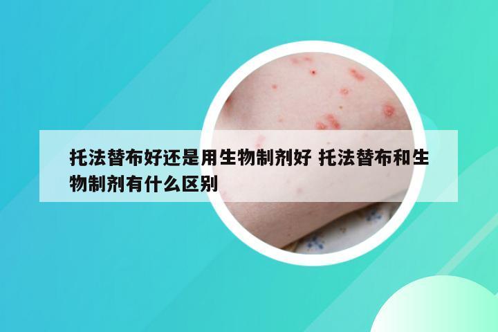 托法替布好还是用生物制剂好 托法替布和生物制剂有什么区别