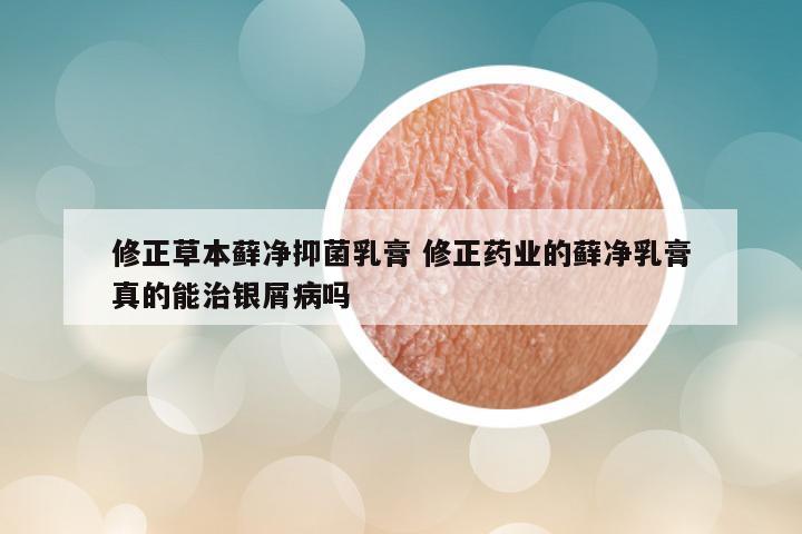 修正草本藓净抑菌乳膏 修正药业的藓净乳膏真的能治银屑病吗