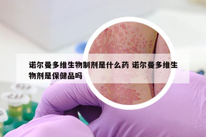 诺尔曼多维生物制剂是什么药 诺尔曼多维生物剂是保健品吗