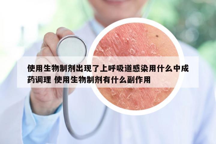 使用生物制剂出现了上呼吸道感染用什么中成药调理 使用生物制剂有什么副作用