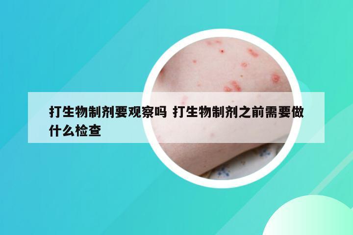 打生物制剂要观察吗 打生物制剂之前需要做什么检查