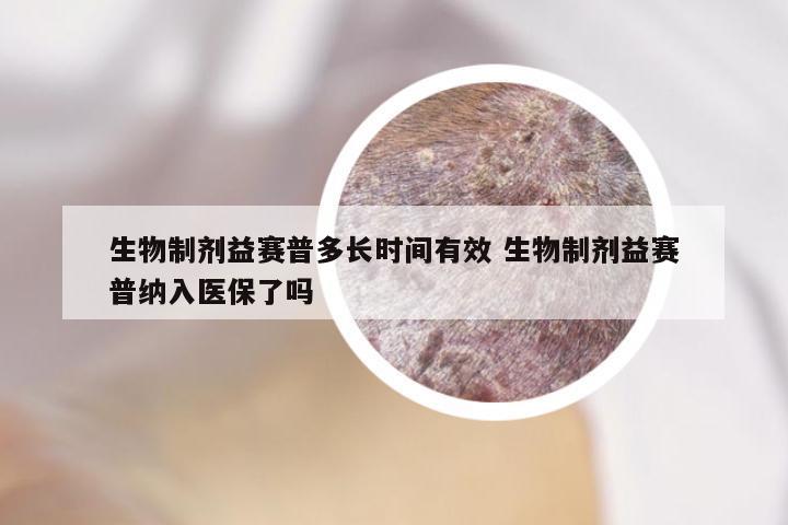 生物制剂益赛普多长时间有效 生物制剂益赛普纳入医保了吗