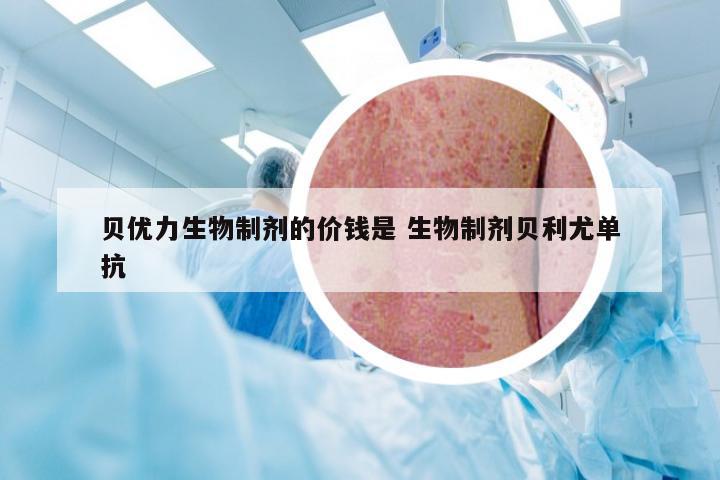 贝优力生物制剂的价钱是 生物制剂贝利尤单抗