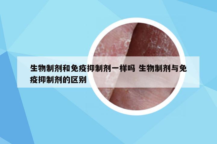 生物制剂和免疫抑制剂一样吗 生物制剂与免疫抑制剂的区别