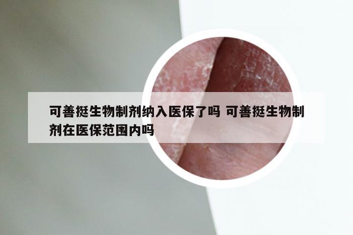 可善挺生物制剂纳入医保了吗 可善挺生物制剂在医保范围内吗