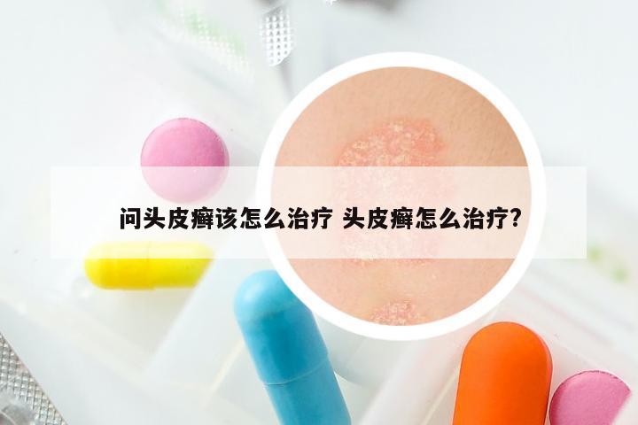 问头皮癣该怎么治疗 头皮癣怎么治疗?