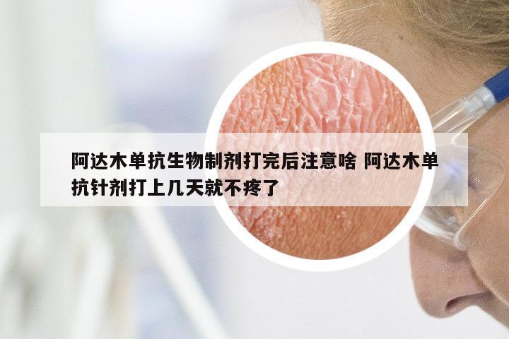 阿达木单抗生物制剂打完后注意啥 阿达木单抗针剂打上几天就不疼了