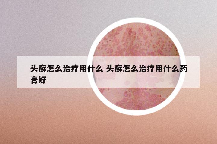 头癣怎么治疗用什么 头癣怎么治疗用什么药膏好