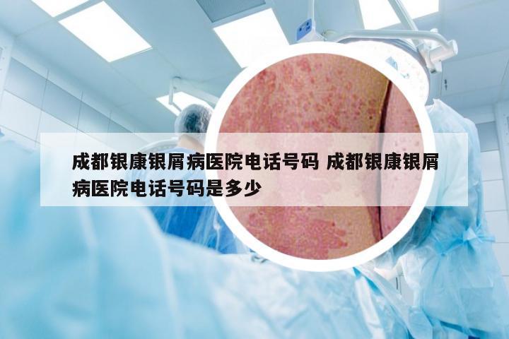 成都银康银屑病医院电话号码 成都银康银屑病医院电话号码是多少