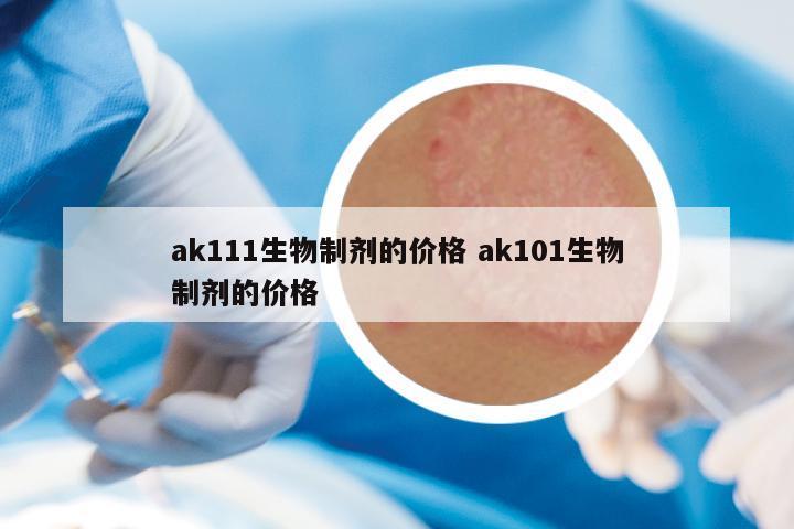 ak111生物制剂的价格 ak101生物制剂的价格