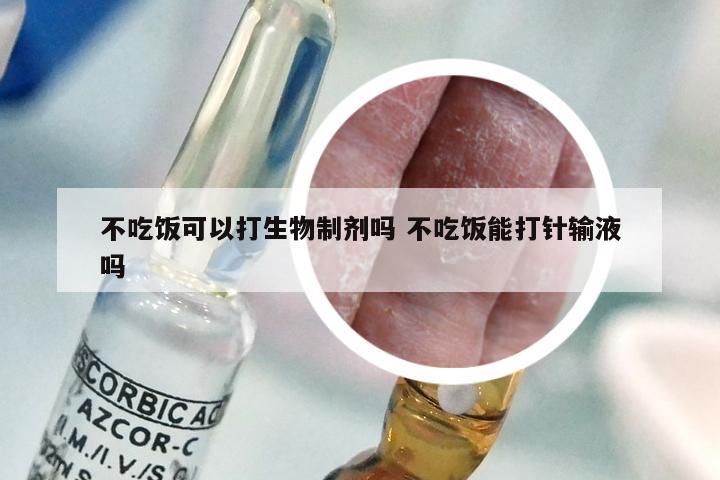 不吃饭可以打生物制剂吗 不吃饭能打针输液吗