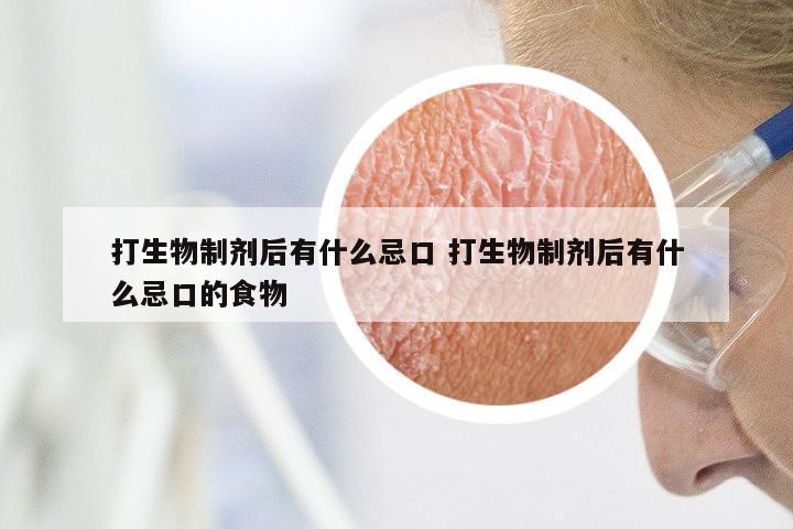 打生物制剂后有什么忌口 打生物制剂后有什么忌口的食物