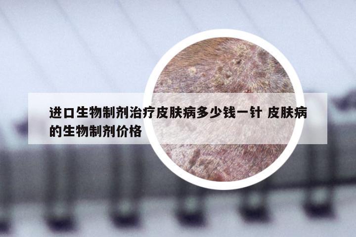 进口生物制剂治疗皮肤病多少钱一针 皮肤病的生物制剂价格