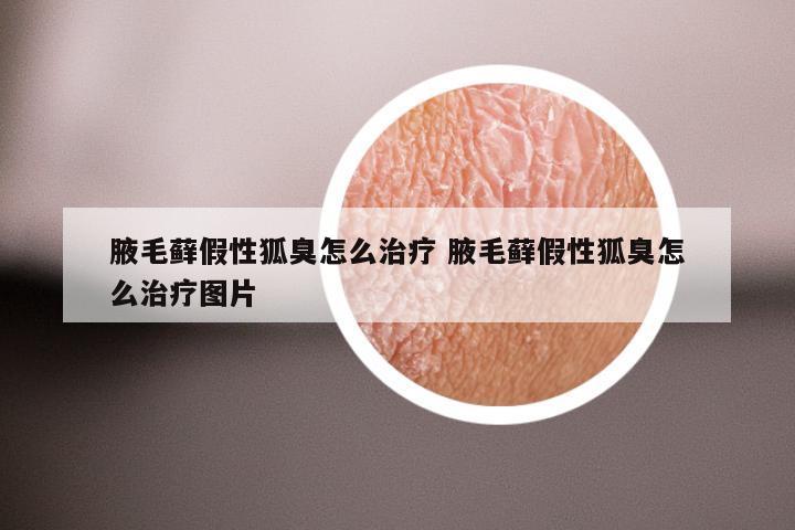 腋毛藓假性狐臭怎么治疗 腋毛藓假性狐臭怎么治疗图片