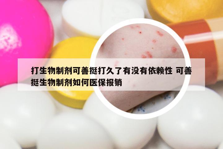 打生物制剂可善挺打久了有没有依赖性 可善挺生物制剂如何医保报销