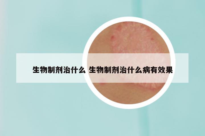 生物制剂治什么 生物制剂治什么病有效果