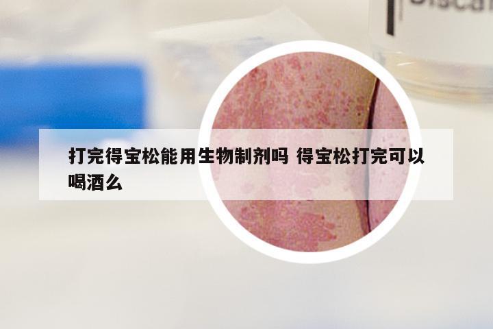 打完得宝松能用生物制剂吗 得宝松打完可以喝酒么