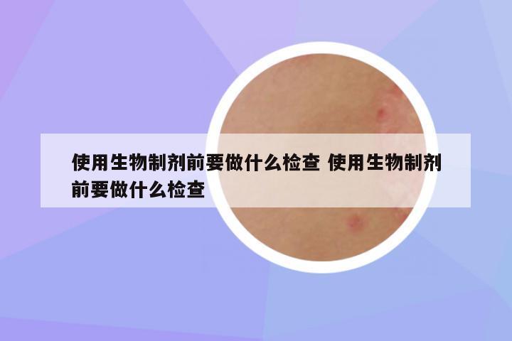 使用生物制剂前要做什么检查 使用生物制剂前要做什么检查