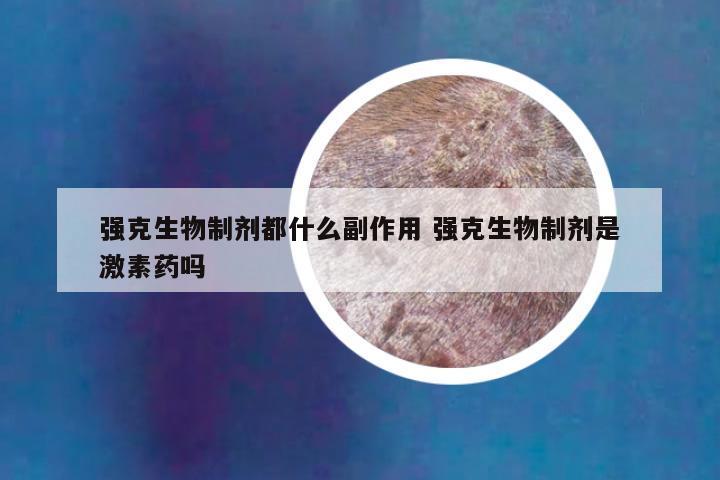 强克生物制剂都什么副作用 强克生物制剂是激素药吗